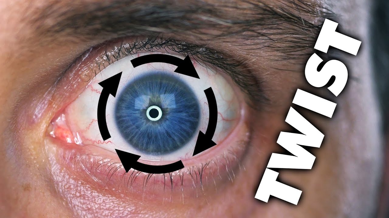 Eye twisting!?
